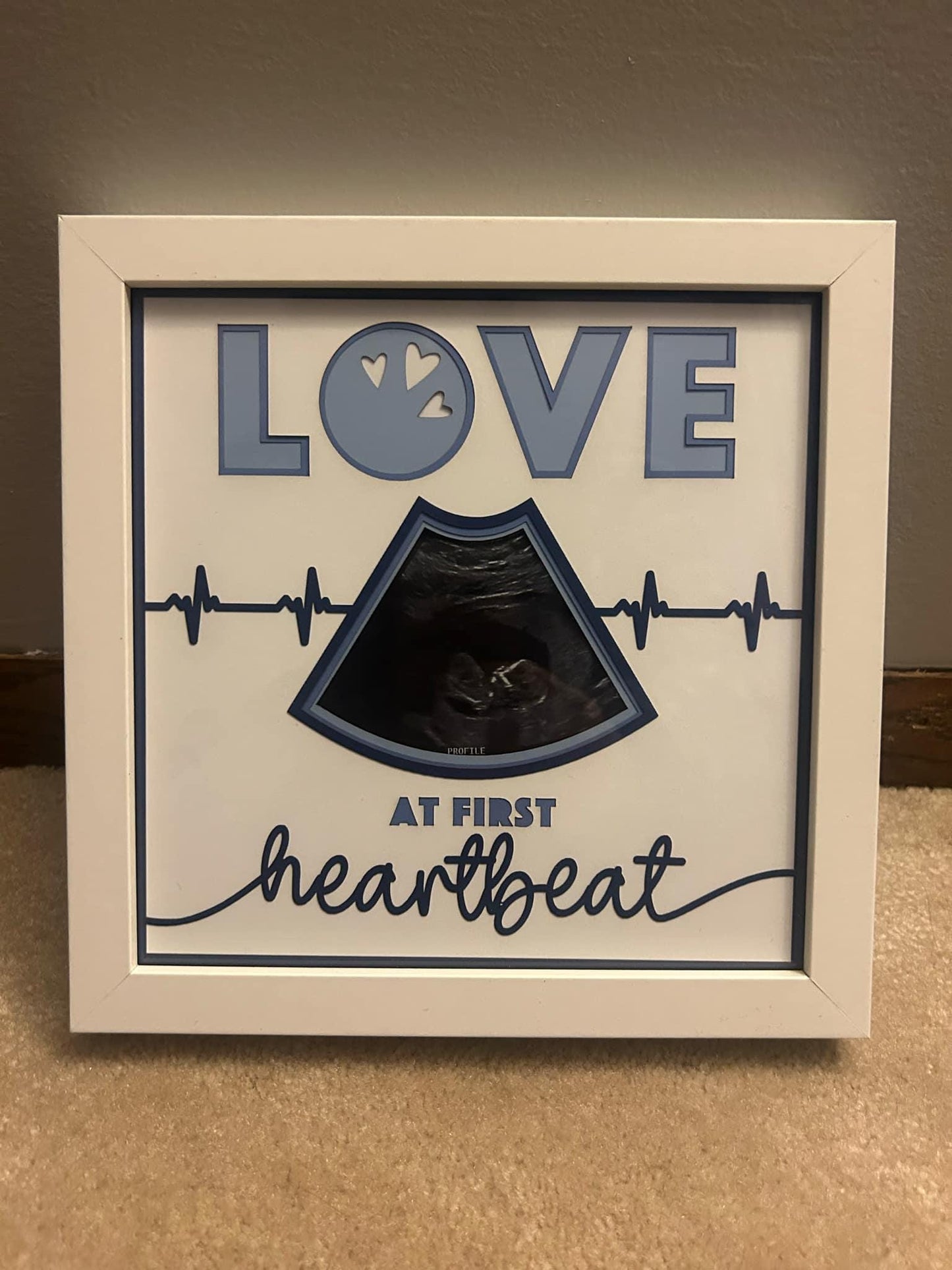 Love at First Heartbeat Baby Ultrasound Sonogram Photo Picture Frame, Baby Shower Gift, Gift for New Parents and Expecting Shadow Box 8"x8"